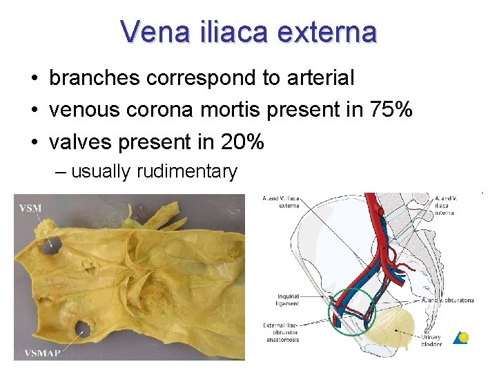 Vena iliaca externa • branches correspond to arterial • venous corona mortis present in