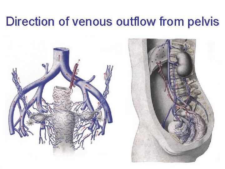 Direction of venous outflow from pelvis Direction of venous outflow from pelvis