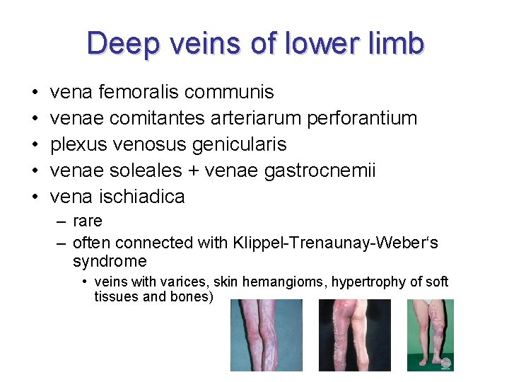 Deep veins of lower limb • • • vena femoralis communis venae comitantes arteriarum