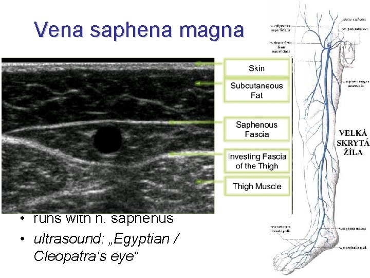 Vena saphena magna • confluens venosus subinguinalis • valvula terminalis + preterminalis • v.