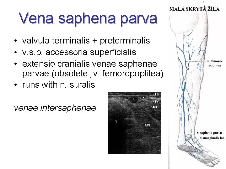 Vena saphena parva • valvula terminalis + preterminalis • v. s. p. accessoria superficialis Vena saphena parva • valvula terminalis + preterminalis • v. s. p. accessoria superficialis