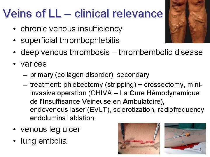 Veins of LL – clinical relevance • • chronic venous insufficiency superficial thrombophlebitis deep