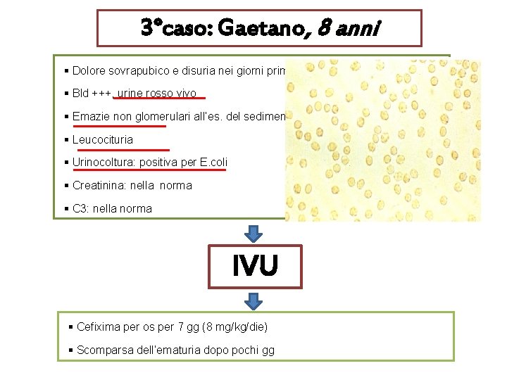 3°caso: Gaetano, 8 anni § Dolore sovrapubico e disuria nei giorni prima della comparsa