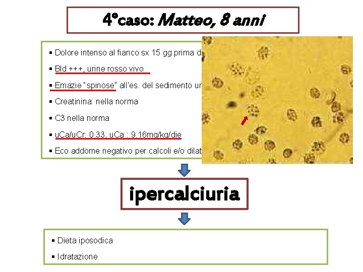 4°caso: Matteo, 8 anni § Dolore intenso al fianco sx 15 gg prima della