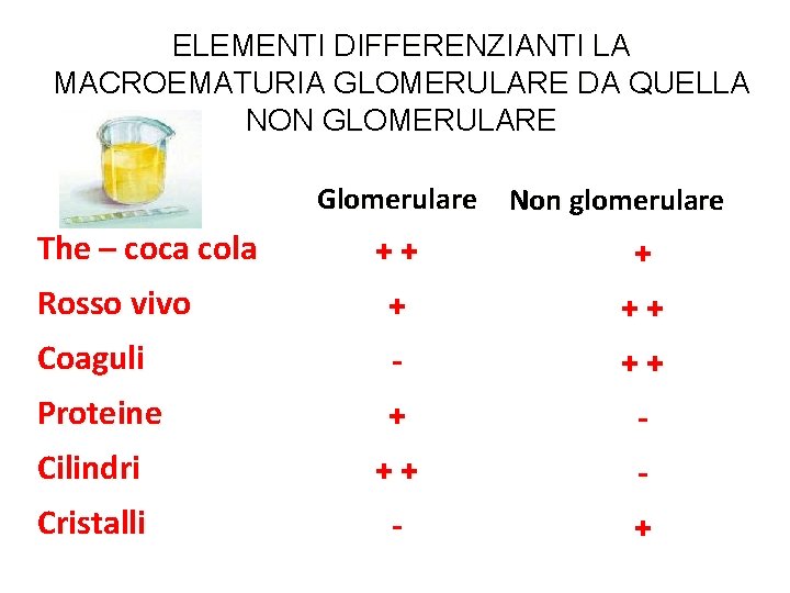 ELEMENTI DIFFERENZIANTI LA MACROEMATURIA GLOMERULARE DA QUELLA NON GLOMERULARE Glomerulare Non glomerulare The –