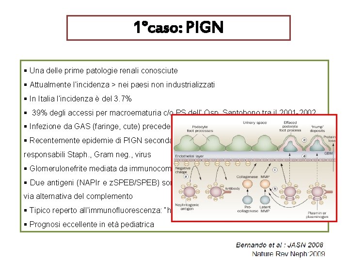 1°caso: PIGN § Una delle prime patologie renali conosciute § Attualmente l’incidenza > nei