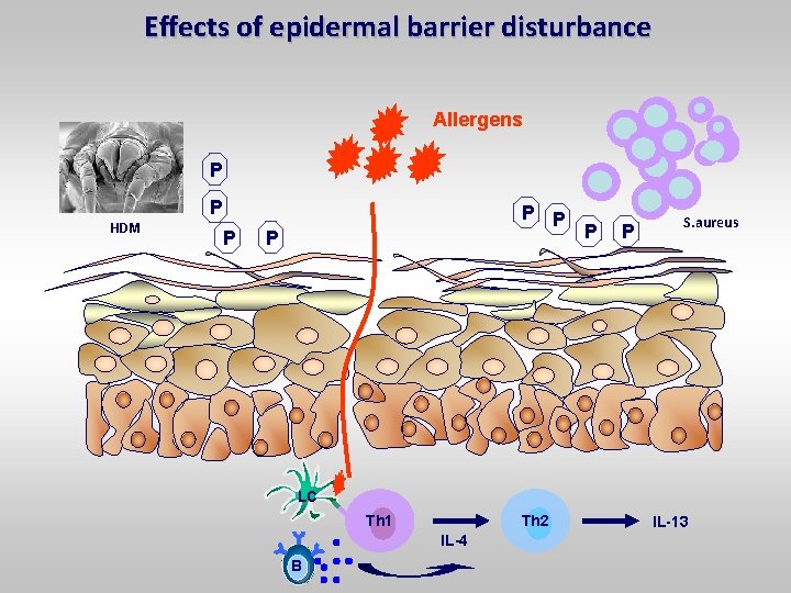 Effects of epidermal barrier disturbance Allergens P P HDM P P P S. aureus