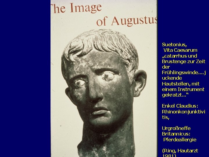 Suetonius, Vita Caesarum „catarrhus und Brustenge zur Zeit der Frühlingswinde. . j uckende Hautstellen,