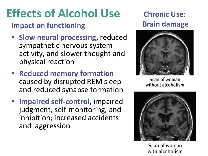 Effects of Alcohol Use Impact on functioning § Slow neural processing, reduced sympathetic nervous