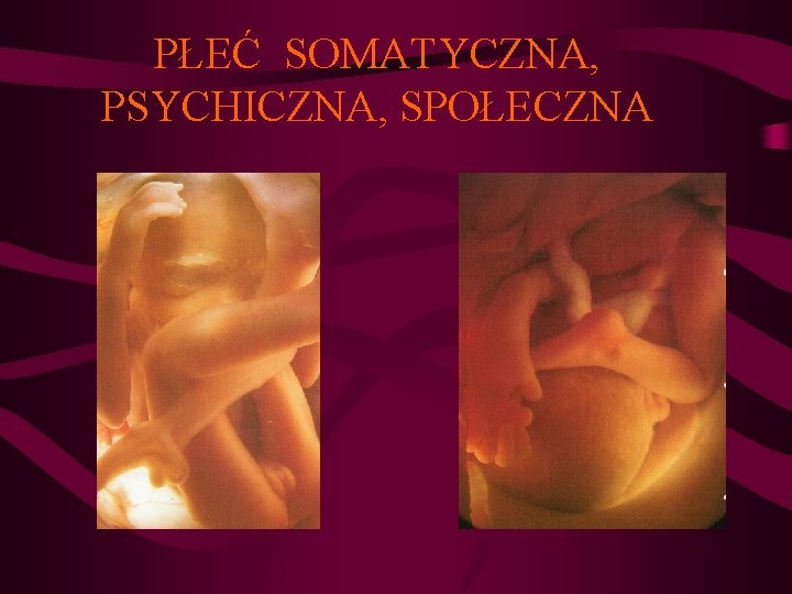 PŁEĆ SOMATYCZNA, PSYCHICZNA, SPOŁECZNA 