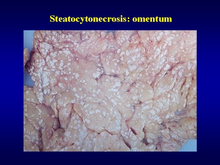 Steatocytonecrosis: omentum 