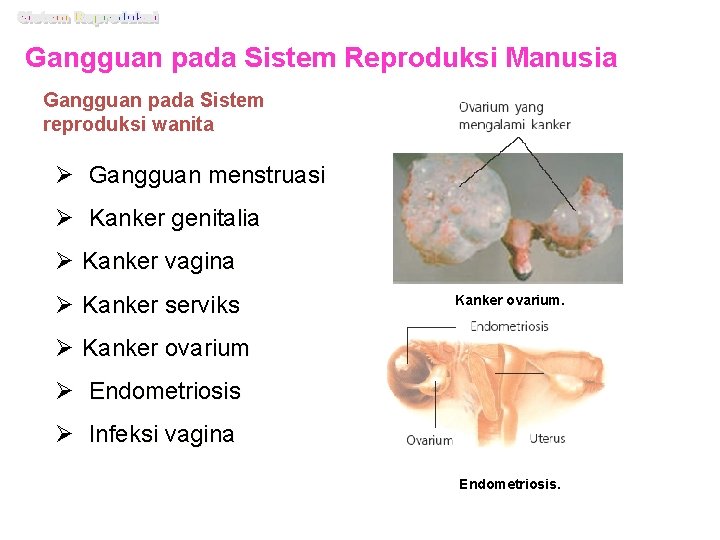 Gangguan pada Sistem Reproduksi Manusia Gangguan pada Sistem reproduksi wanita Ø Gangguan menstruasi Ø