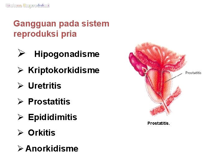 Gangguan pada sistem reproduksi pria Ø Hipogonadisme Ø Kriptokorkidisme Ø Uretritis Ø Prostatitis Ø