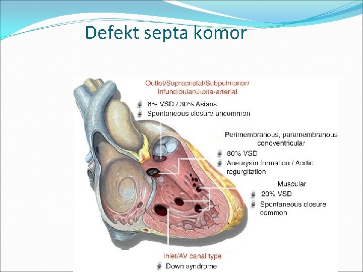 Defekt septa komor 