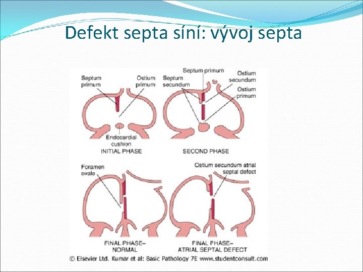 Defekt septa síní: vývoj septa 