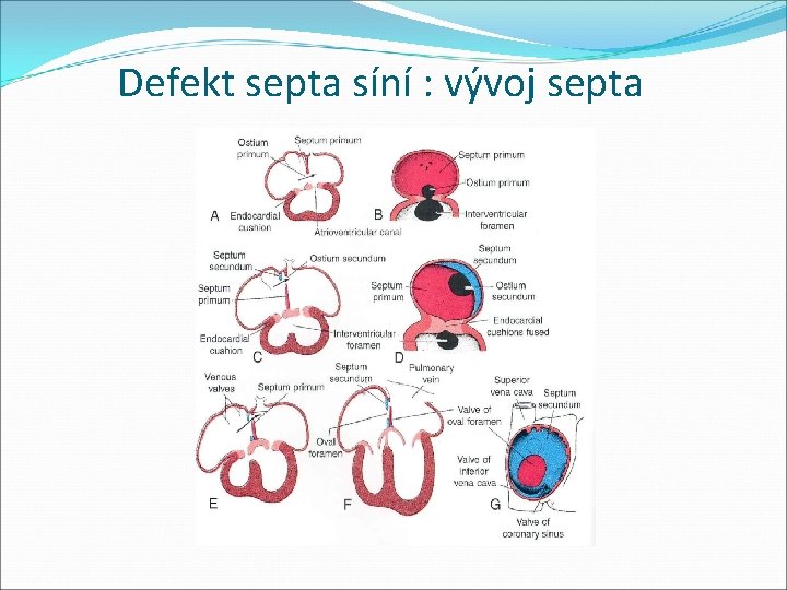 Defekt septa síní : vývoj septa 