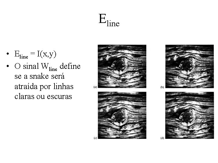 Eline • Eline = I(x, y) • O sinal Wline define se a snake