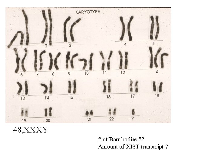 48, XXXY # of Barr bodies ? ? Amount of XIST transcript ? 