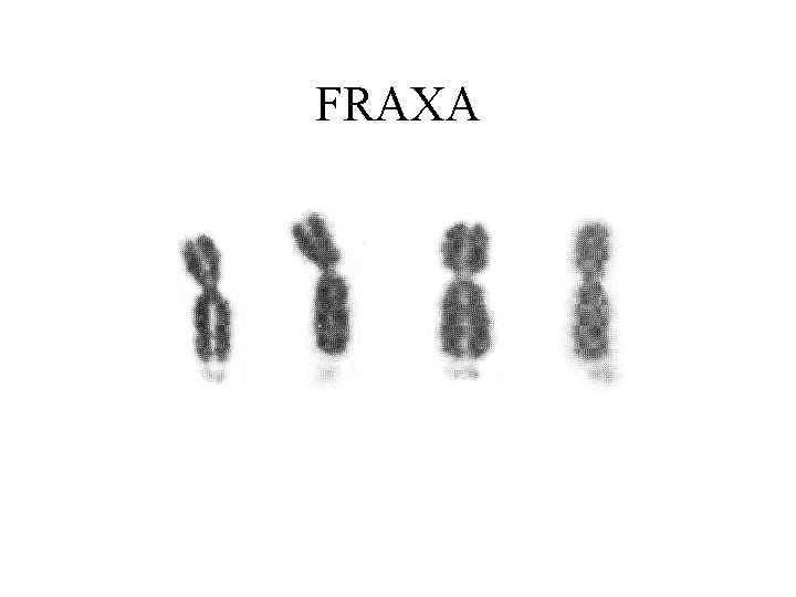 FRAXA 