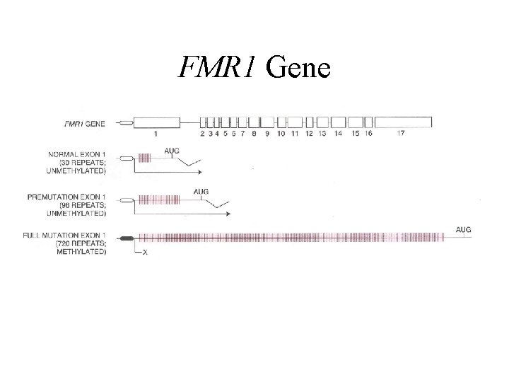 FMR 1 Gene 