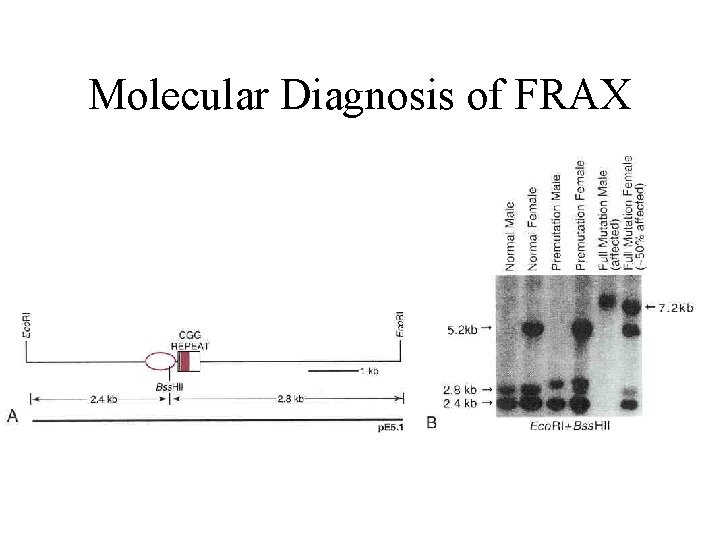 Molecular Diagnosis of FRAX 