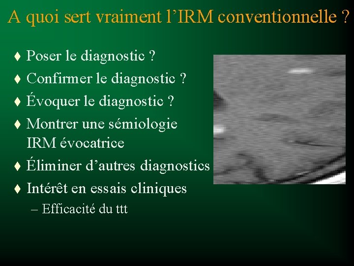 A quoi sert vraiment l’IRM conventionnelle ? t t t Poser le diagnostic ?