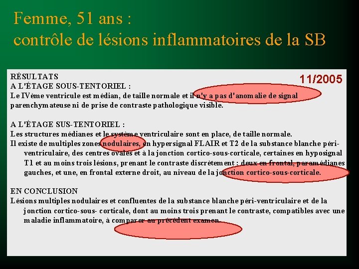 Femme, 51 ans : contrôle de lésions inflammatoires de la SB RÉSULTATS 11/2005 A