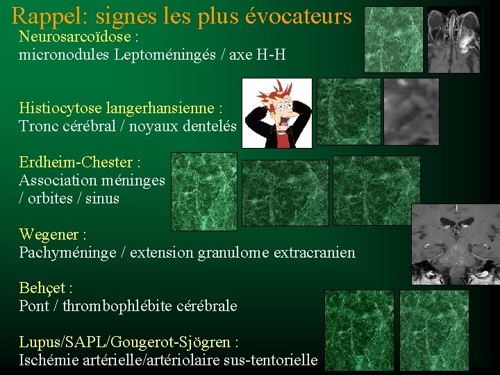 Rappel: signes les plus évocateurs Neurosarcoïdose : micronodules Leptoméningés / axe H-H Histiocytose langerhansienne
