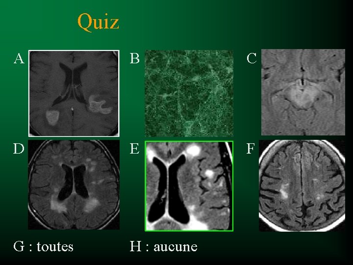 Quiz A B C D E F G : toutes H : aucune 
