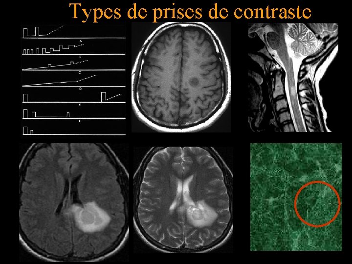 Types de prises de contraste 