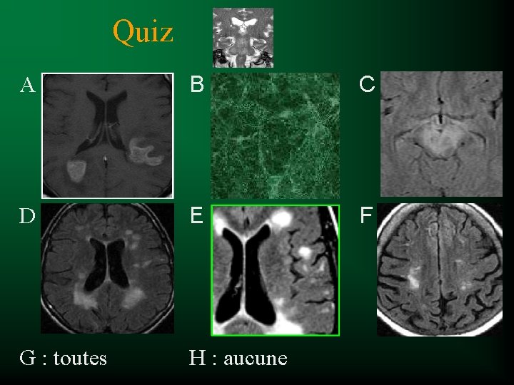 Quiz A B C D E F G : toutes H : aucune 