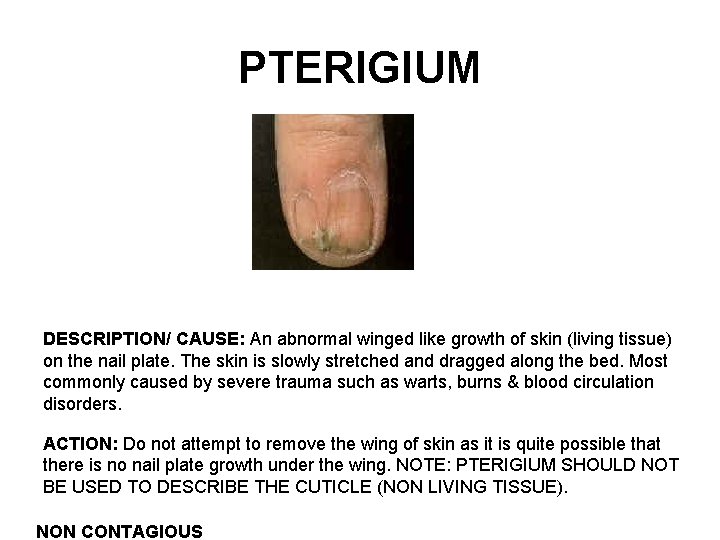 PTERIGIUM DESCRIPTION/ CAUSE: An abnormal winged like growth of skin (living tissue) on the