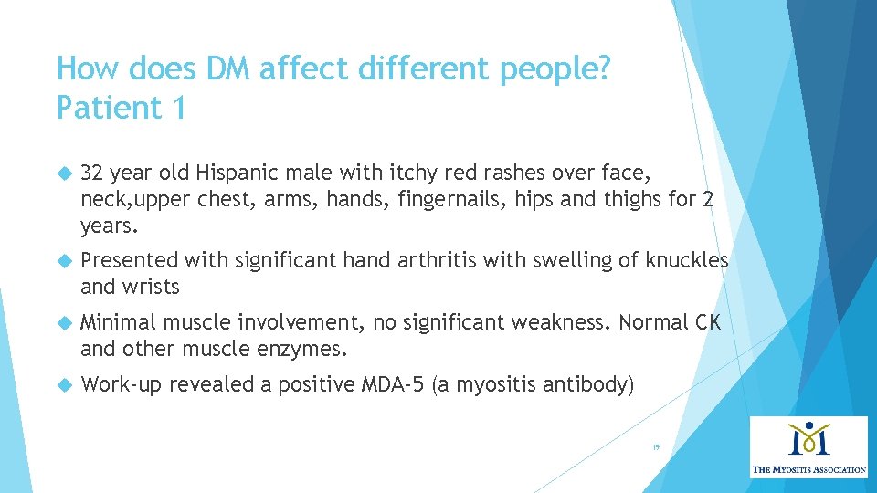 How does DM affect different people? Patient 1 32 year old Hispanic male with