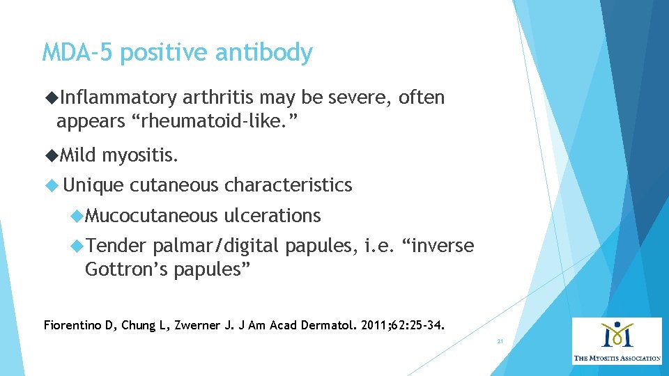 MDA-5 positive antibody Inflammatory arthritis may be severe, often appears “rheumatoid-like. ” Mild myositis.