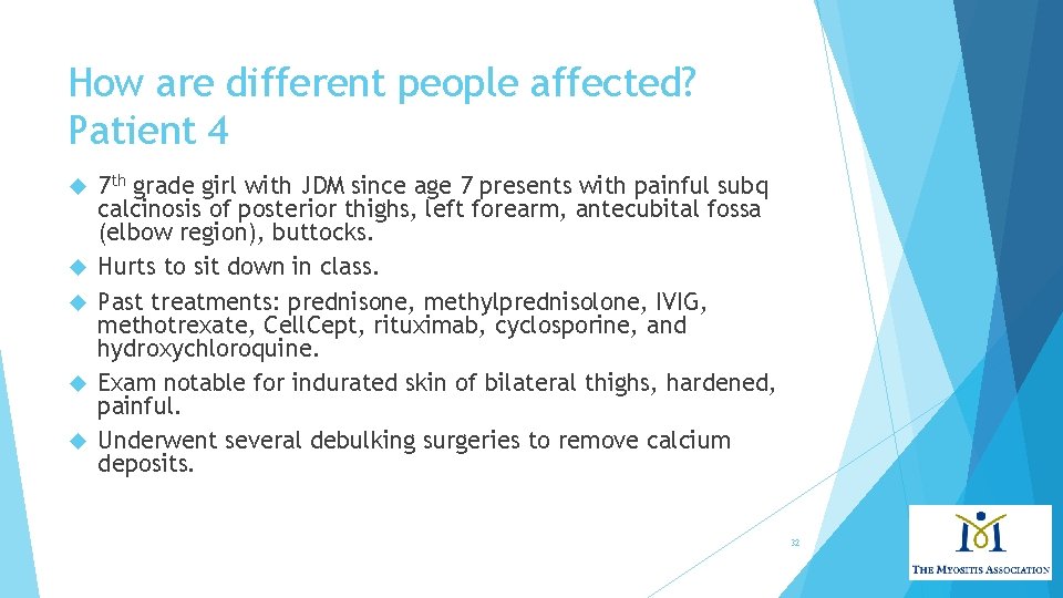 How are different people affected? Patient 4 7 th grade girl with JDM since