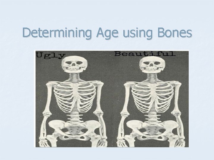 Determining Age using Bones 