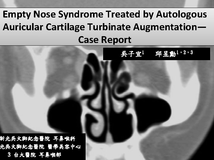 Empty Nose Syndrome Treated by Autologous Auricular Cartilage Turbinate Augmentation— Case Report 新光吳火獅紀念醫院 耳鼻喉科