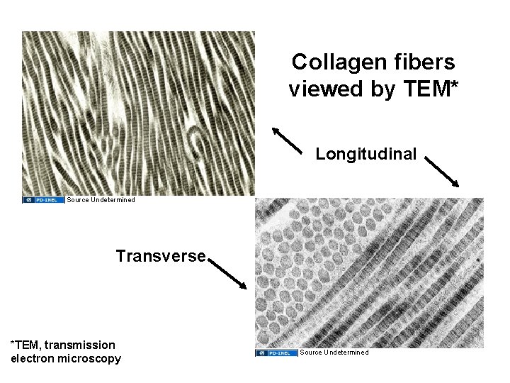 Collagen fibers viewed by TEM* Longitudinal Source Undetermined Transverse *TEM, transmission electron microscopy Source