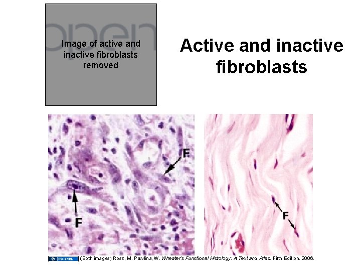 Image of active and inactive fibroblasts removed Active and inactive fibroblasts (Both images) Ross,