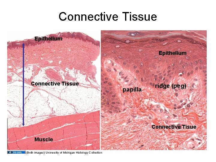 Connective Tissue Epithelium Connective Tissue papilla ridge (peg) Connective Tisue Muscle (Both images) University