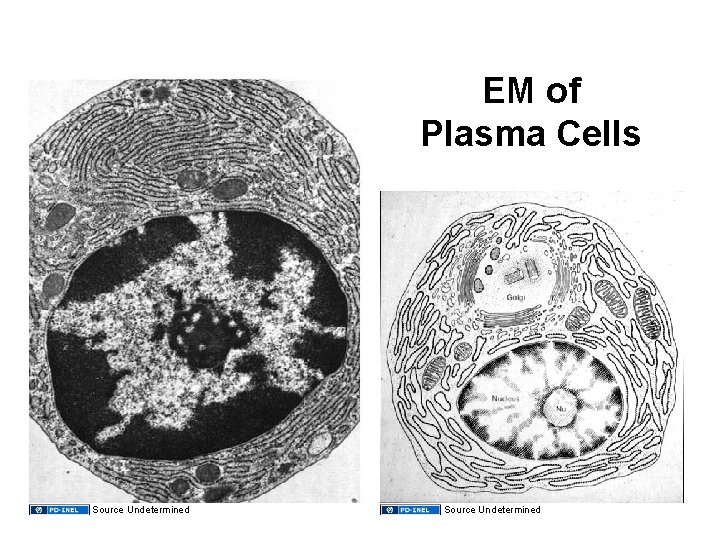 EM of Plasma Cells Source Undetermined 