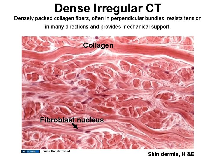 Dense Irregular CT Densely packed collagen fibers, often in perpendicular bundles; resists tension in