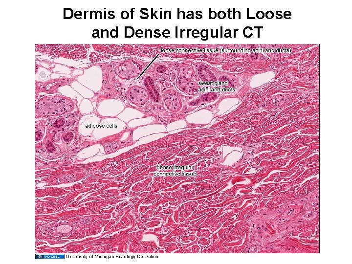 Dermis of Skin has both Loose and Dense Irregular CT Loose CT sweat gland