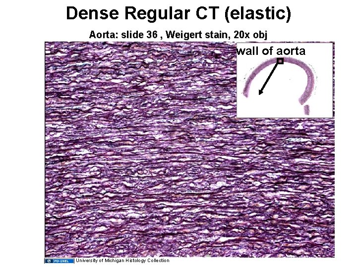 Dense Regular CT (elastic) Aorta: slide 36 , Weigert stain, 20 x obj wall
