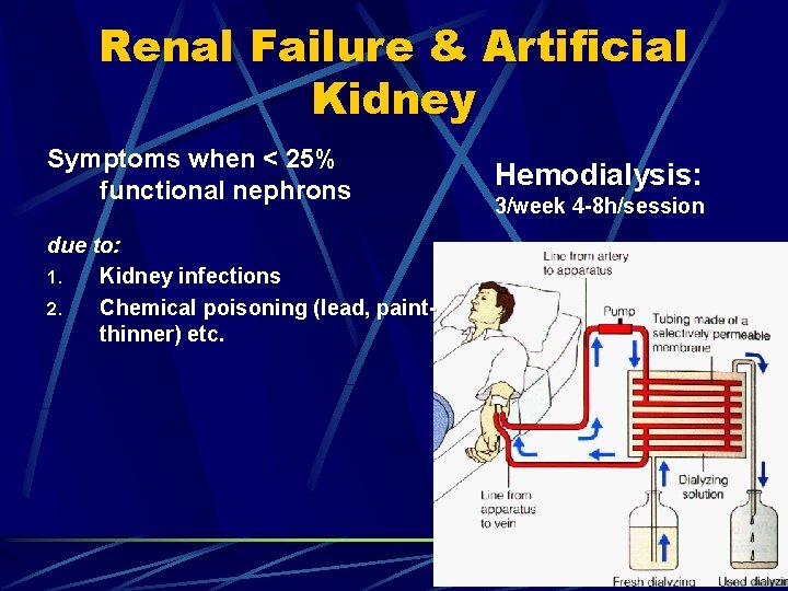 Renal Failure & Artificial Kidney Symptoms when < 25% functional nephrons due to: 1.