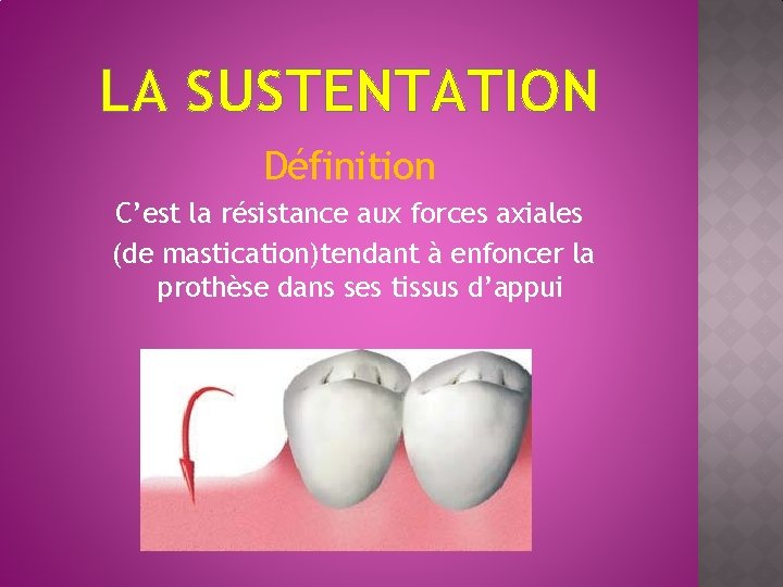 LA SUSTENTATION Définition C’est la résistance aux forces axiales (de mastication)tendant à enfoncer la