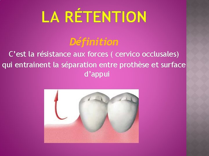 LA RÉTENTION Définition C’est la résistance aux forces ( cervico occlusales) qui entrainent la