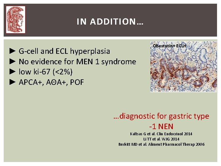 IN ADDITION… ► G-cell and ECL hyperplasia ► No evidence for MEN 1 syndrome IN ADDITION… ► G-cell and ECL hyperplasia ► No evidence for MEN 1 syndrome
