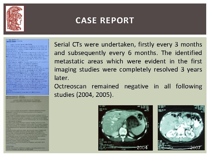 CASE REPORT Serial CTs were undertaken, firstly every 3 months and subsequently every 6 CASE REPORT Serial CTs were undertaken, firstly every 3 months and subsequently every 6