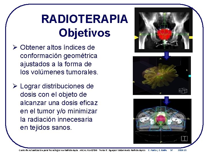 RADIOTERAPIA Objetivos Ø Obtener altos índices de conformación geométrica ajustados a la forma de RADIOTERAPIA Objetivos Ø Obtener altos índices de conformación geométrica ajustados a la forma de